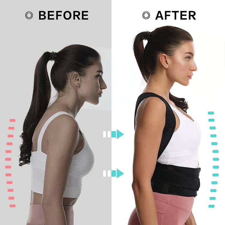 Posture Corrector Belt For Spine Support And Back Pain - Universal Free Size For Men & Women ✅