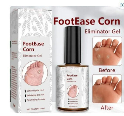 Coerty™ Feet Corn Removal Gel (Buy 1 Get 1 Free 😍) 🔥 Limited Time Offer 🔥