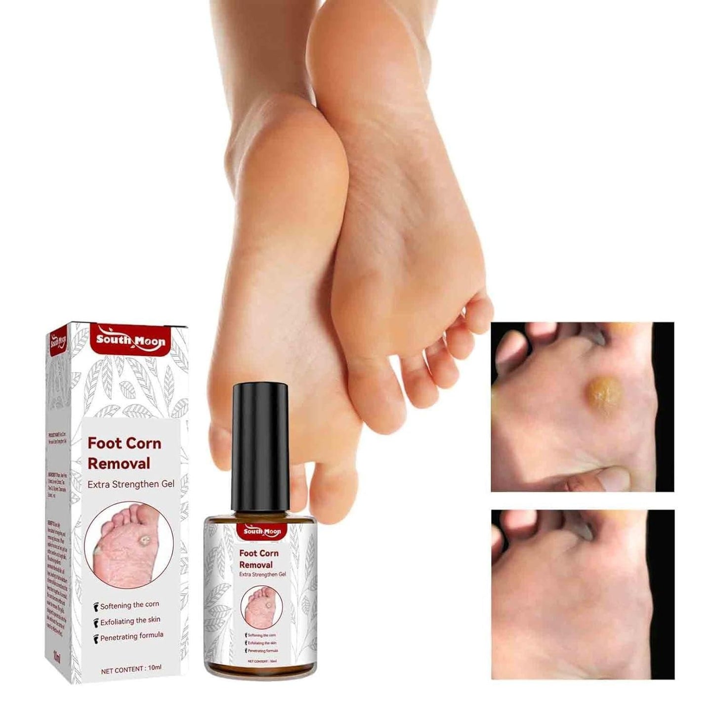 Coerty™ Feet Corn Removal Gel (Buy 1 Get 1 Free 😍) 🔥 Limited Time Offer 🔥